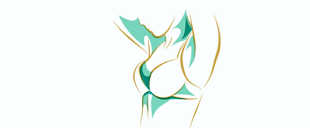 Breast Reduction (Reduction Mammoplasty) - 