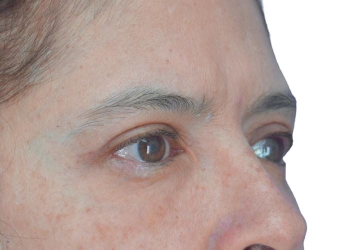 Close-up of a woman's face in profile, showing both eyes and surrounding skin with light freckles and fine eyebrows.