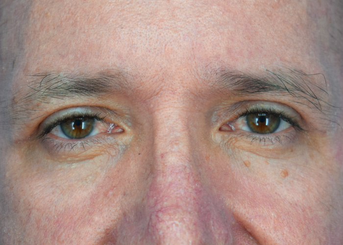 Close-up of a man's face focusing on brown eyes, nose, and surrounding skin texture.