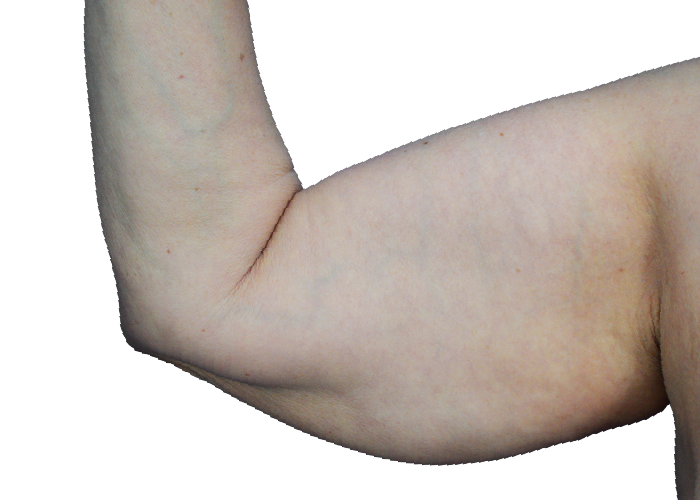 Close-up of a bent arm showing the elbow and soft inner curve at the bend.