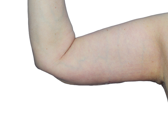 Close-up of a baby's bent arm, showing the elbow and forearm with soft skin in a relaxed pose.
