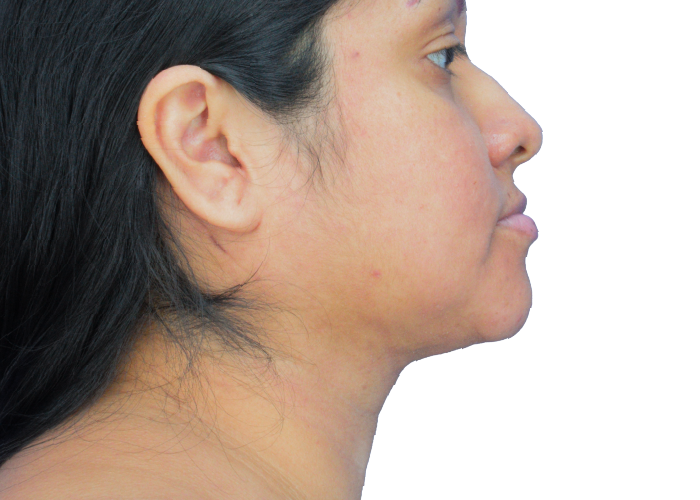Profile side view of a young woman with long dark hair, showing her face, ear, jawline, and neck against a white background.