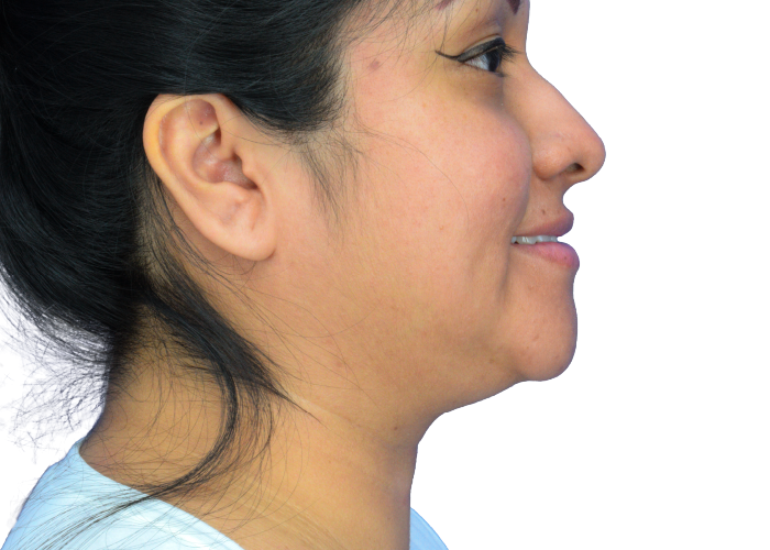 Profile of a woman facing right, showing her jawline, chin, and neck with hair tied back.