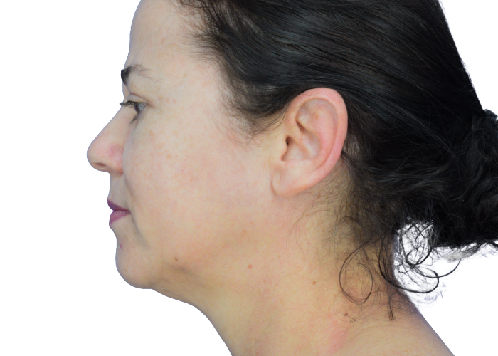 Profile view of a woman facing left, showing the side of her face, ear, and neck with dark hair tied back.