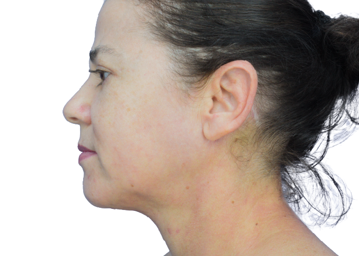 Side profile of a woman's head and neck with tied-back hair, facing left