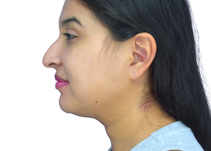Profile of a woman with long dark hair, facing left; wearing pink lipstick and a light blue top; visible nose and ear