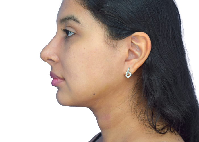Profile view of a woman with dark hair facing left, wearing a small silver hoop earring.