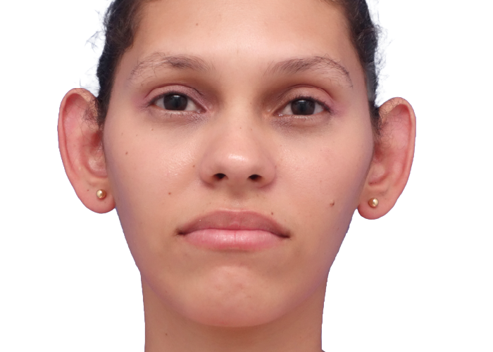 Front-facing portrait of a young woman with prominent ears and a neutral expression.