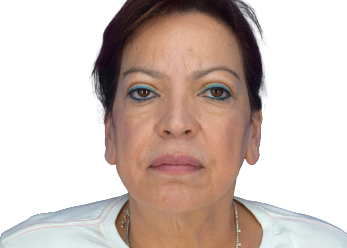 Close-up of a woman with blue eyeliner looking straight ahead.
