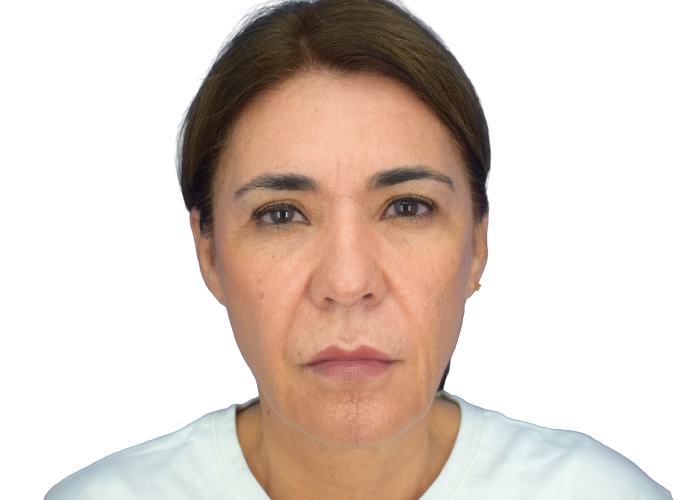 Close-up portrait of a middle-aged woman with a neutral expression against a white background.