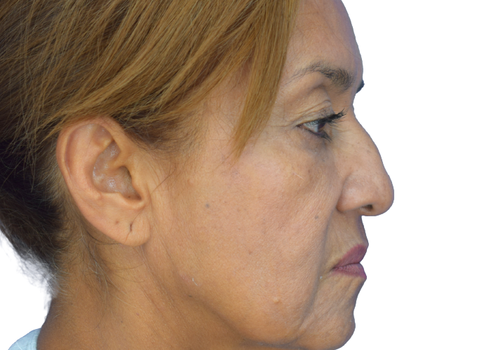 Profile view of a middle-aged woman facing right, with light brown hair pulled back and a white background.