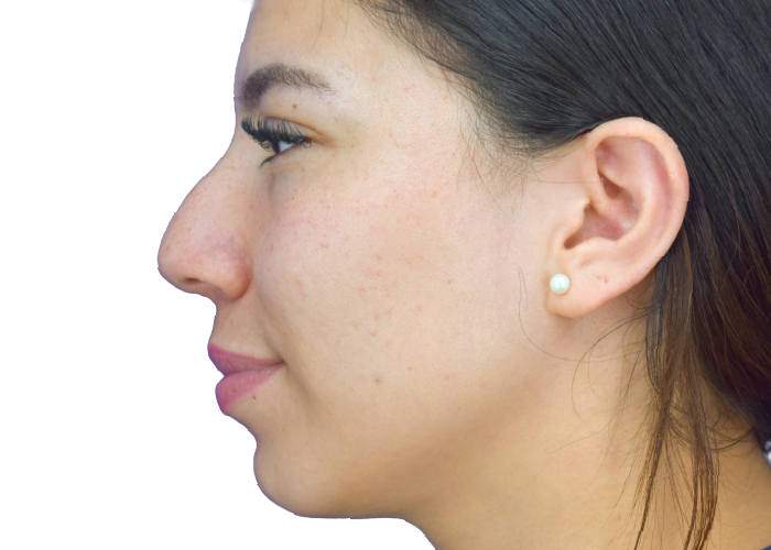 Profile view of a young woman facing left, with dark hair, pearl stud earring, and light freckles on her cheek.