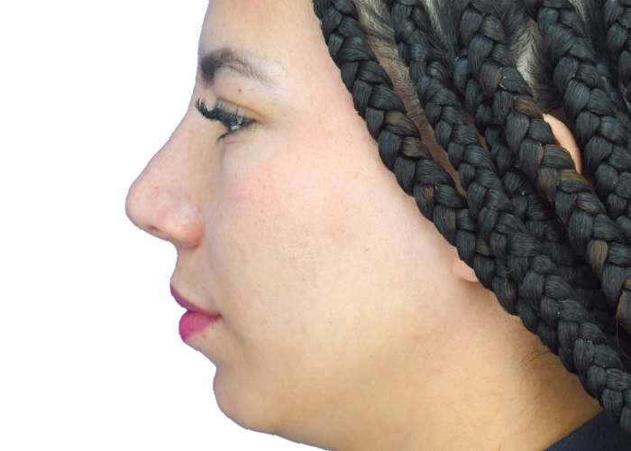 Profile view of a woman facing left with long black braided hair cascading along the head and neck against a white background.