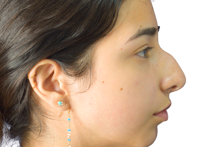 Profile view of a young woman wearing a turquoise stud earring with a dangling chain, facing right on a white background.