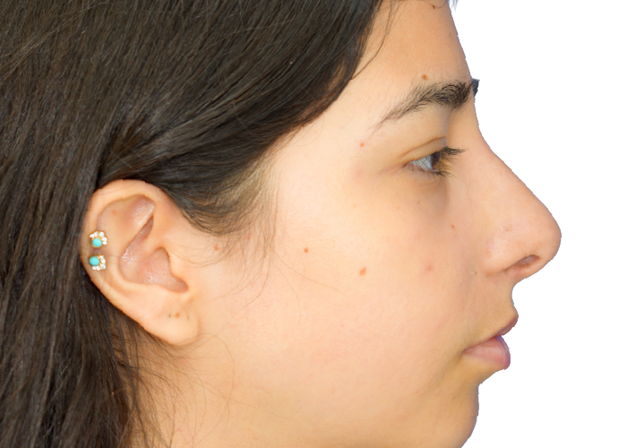 Side profile of a young woman facing right, with dark hair and turquoise stud earrings in the ear
