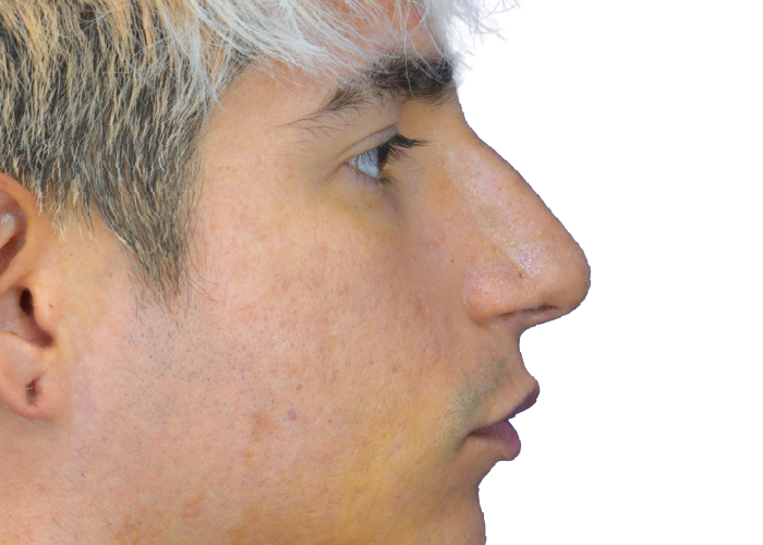 Profile view of a young man facing right, with short light hair and visible pores on his cheek.
