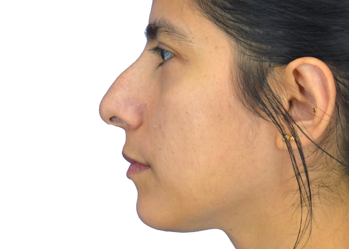 Profile view of a woman facing left with dark hair and small gold ear studs/piercings.